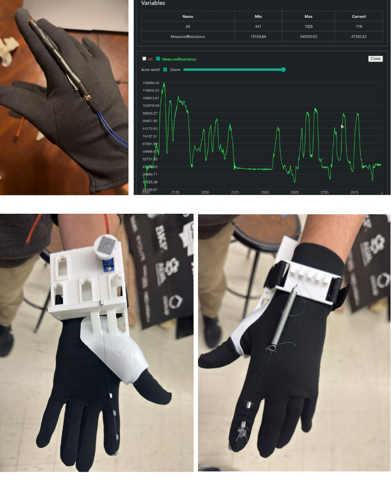 Patient hand rehabilitation